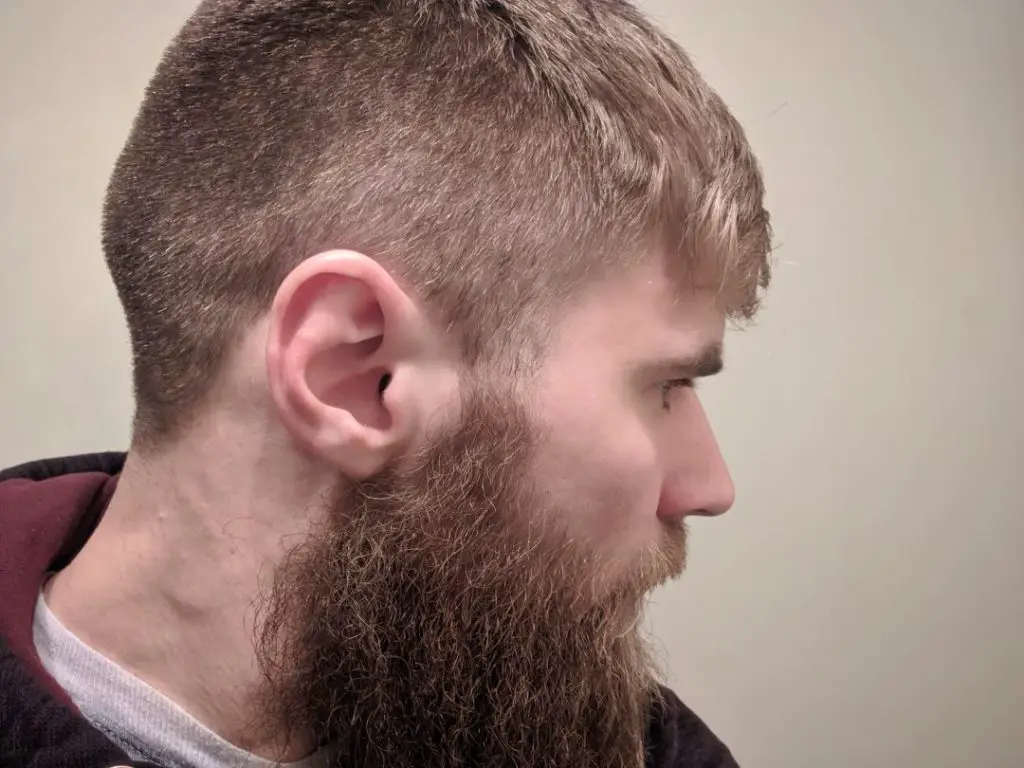 What You Need To Know About Cauliflower Ear In BJJ Project BJJ